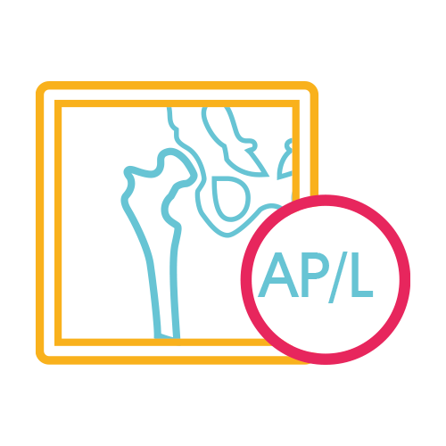 Muslo (Femur) Izquierdo AP y LAT.