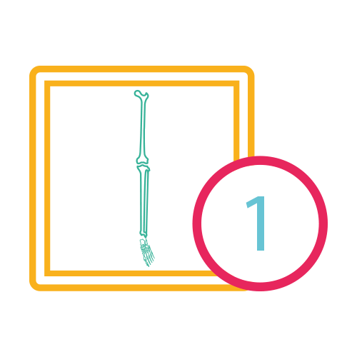 Pierna Una Proyección