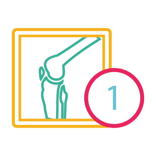 Rodilla 1 Proyección