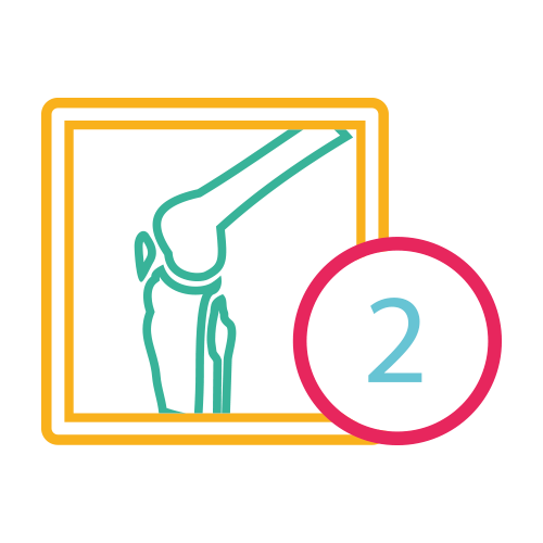 Rodilla Izquierda 2 Proy. (Ap y Lat.)