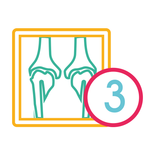 Rodillas Tang. 3 Proy. (30-60-90) Axiales