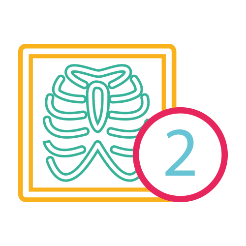 Tórax Osea 2 proyecciones (AP y Lat) Digital