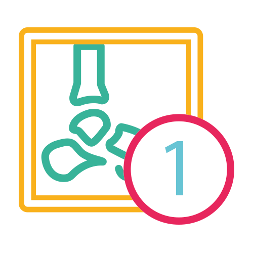 Tobillo Una Proyeccion