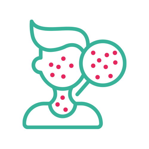 Ac. Anti - Sarampión IgG e IgM