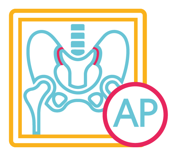 Articula Sacro Iliaca AP (una)