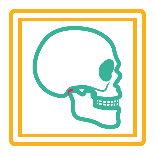 Artic. Temporo Maxilar Bilateral