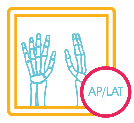 Mano Bilateral 2 Proy. (Ap y Lat.)