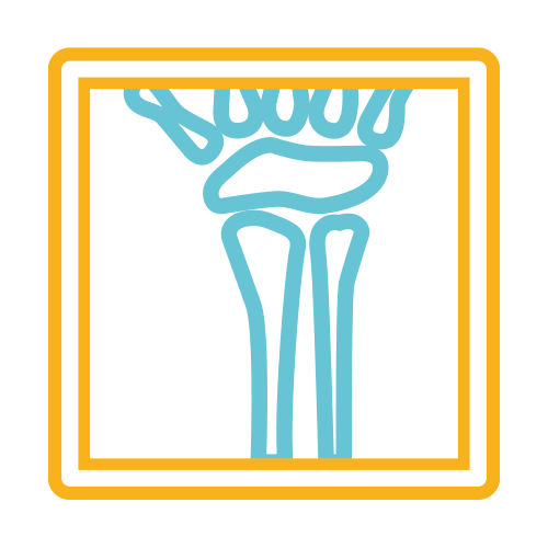 Impresión de 2 Acetatos